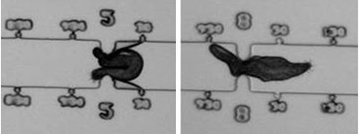 IMG: protozoa in constriction